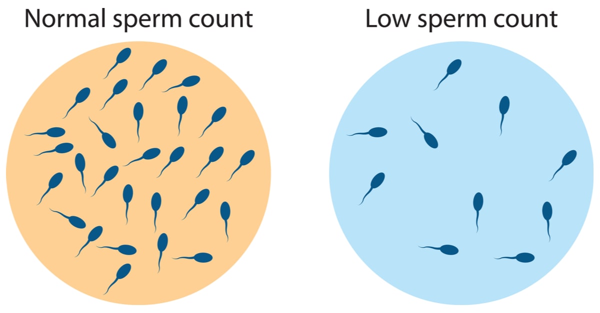 صورة تقارن بين عدد الحيوانات المنوية الطبيعي والمنخفض
