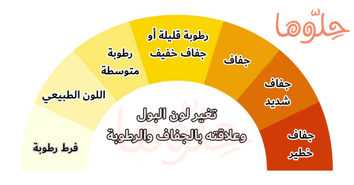 صورة لون البول الطبيعي الأصفر ولون البول الغامق والجفاف